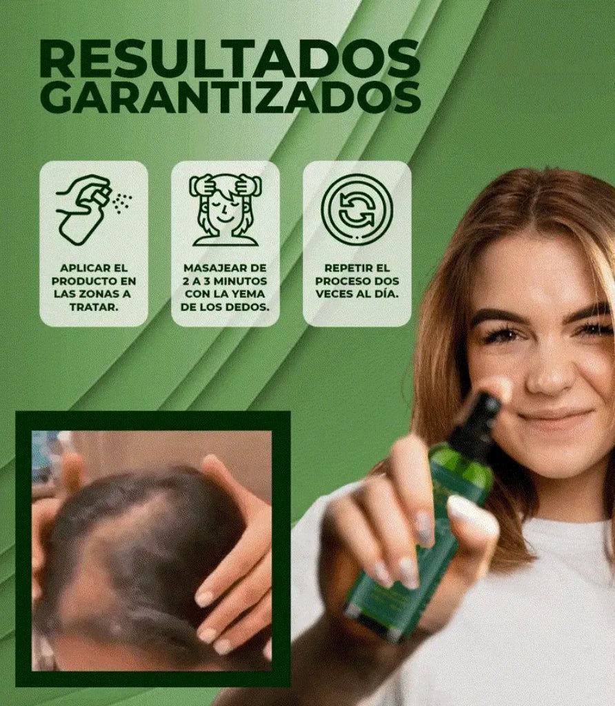 OUHOE - CRECIMIENTO Y CONTROL CAIDA DE CABELLO